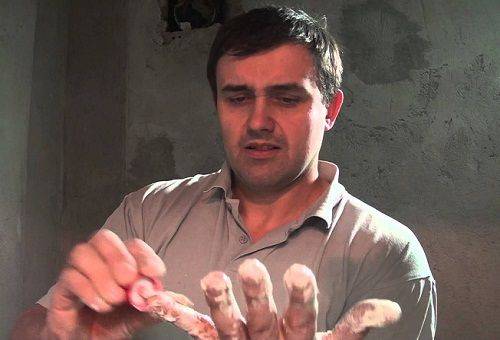 polyurethane foam on a man’s hand