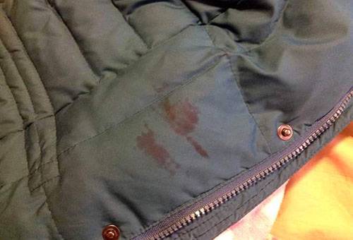 Down jacket stain