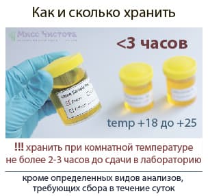 How much urine to store for reliable analysis