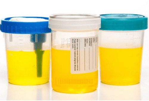 recipiente de urină din plastic