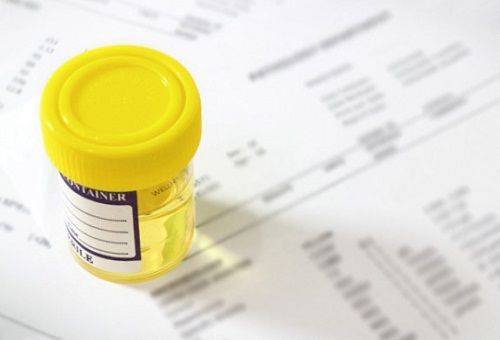 urine in an analysis container
