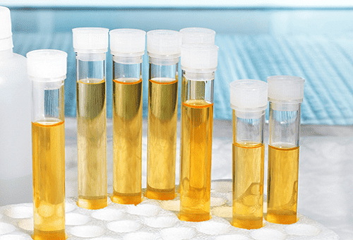 urine test tubes