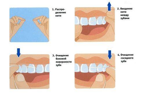 seqüência de uso do fio dental