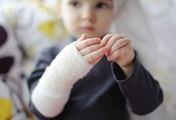 Uma criança com queimadura nas mãos